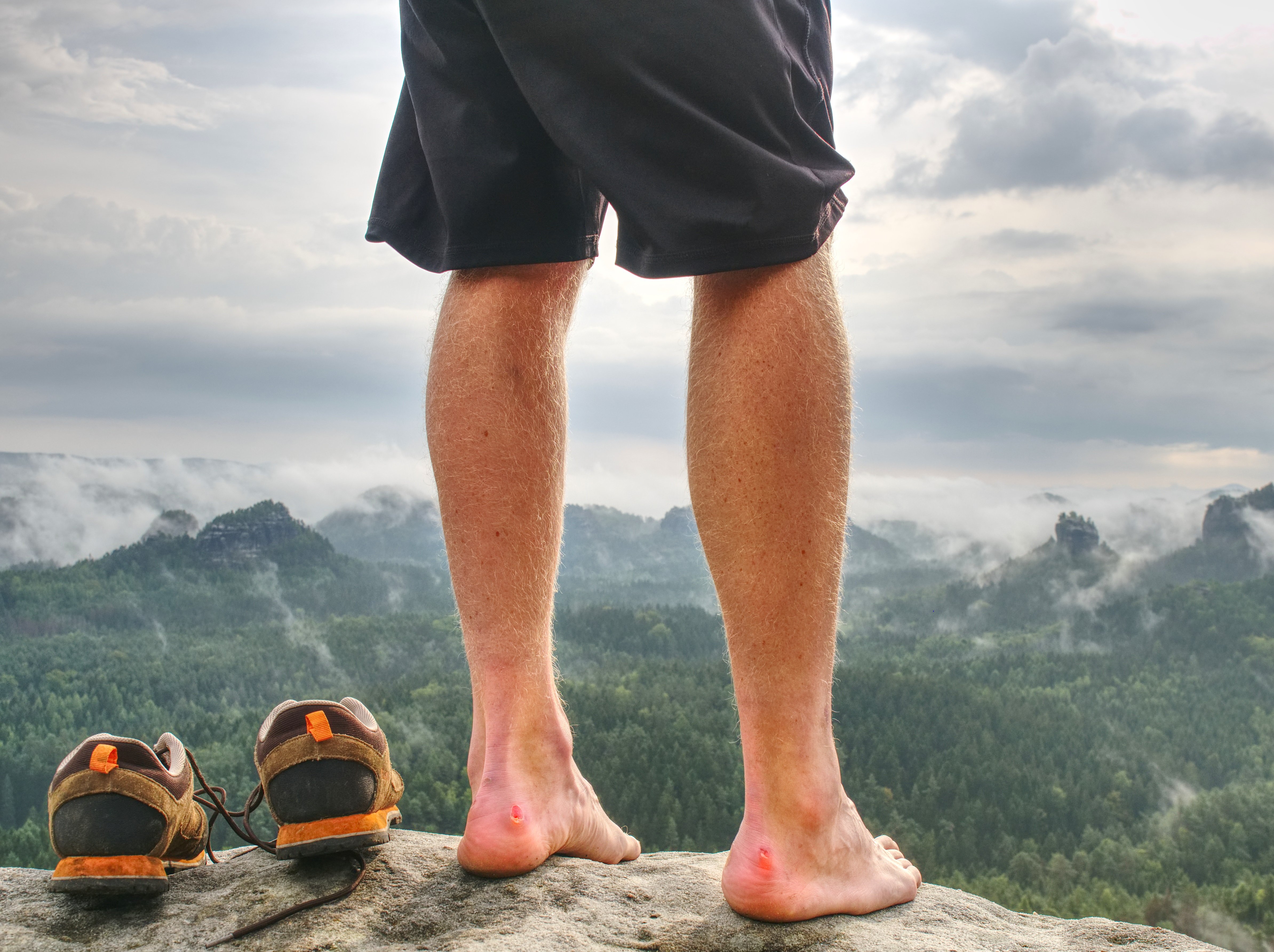 Foot care when hiking 